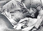 A child left to starve by Stalin's man made famine 1932-1933.Poltava Oblast